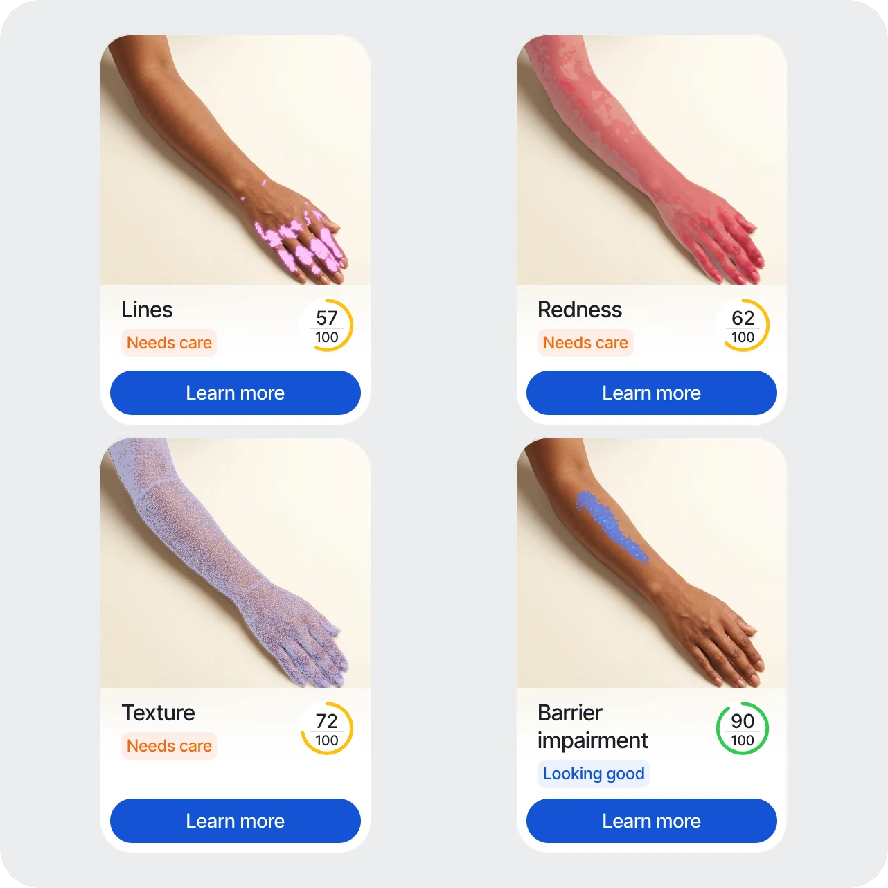 Four body metric cards with detection maps on an arm: lines, redness, texture, and barrier impairment scores