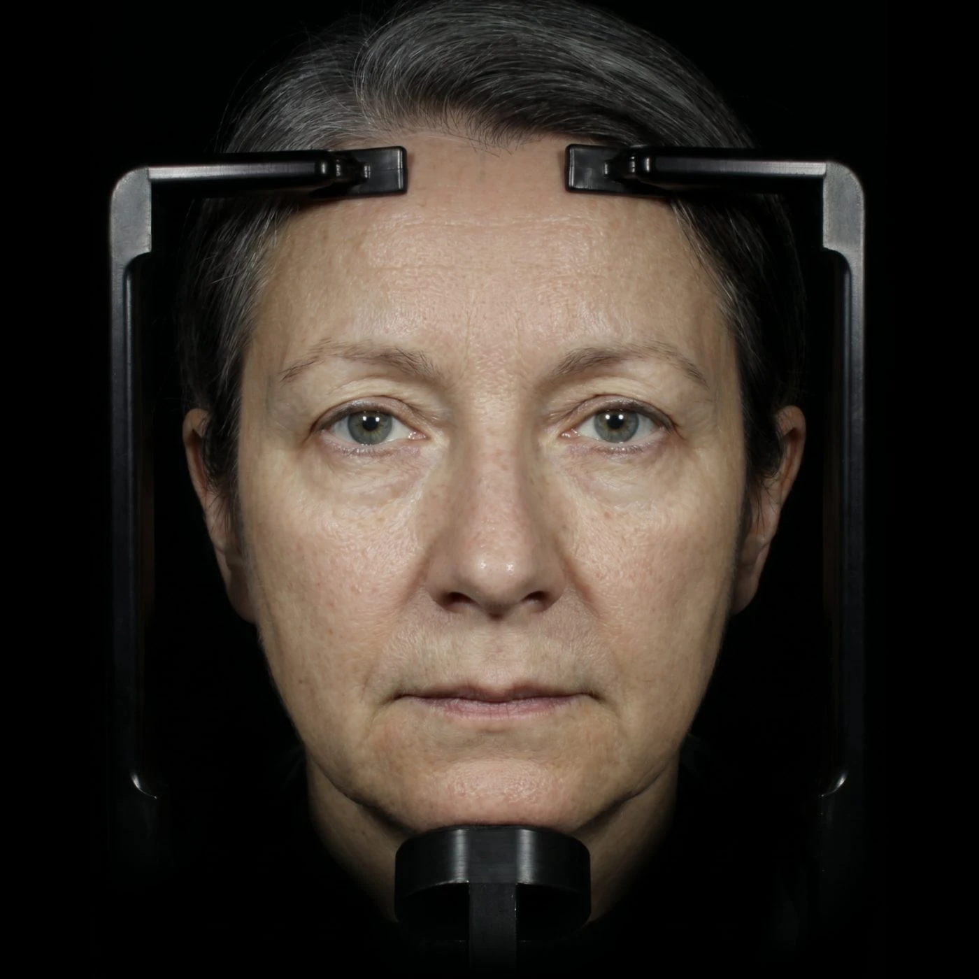 Participant in a clinical skin-imaging device